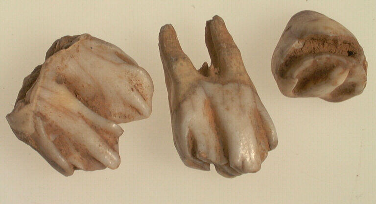 Dent (3)_0