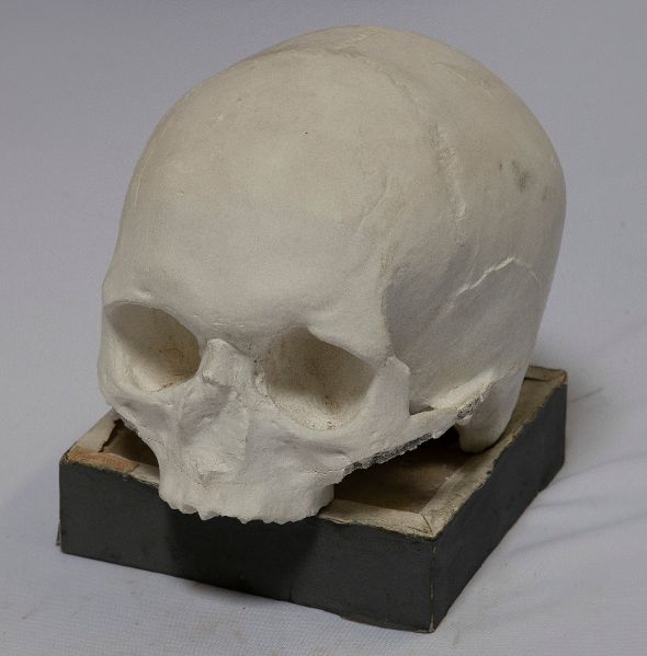 Moulage anatomique_2