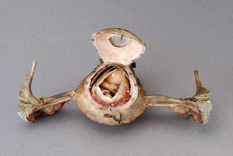 Foetus de 3 mois_0