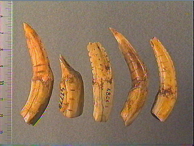 Dent_1