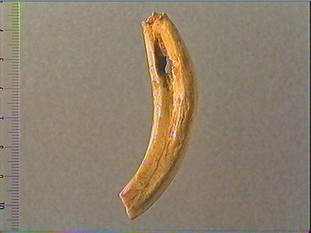 Dent_0