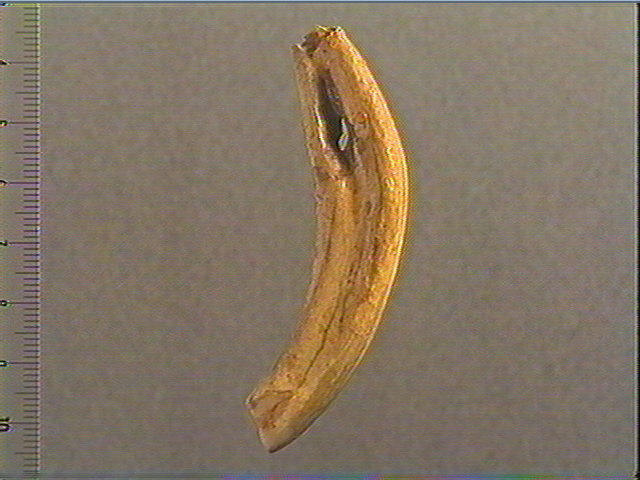 Dent_1