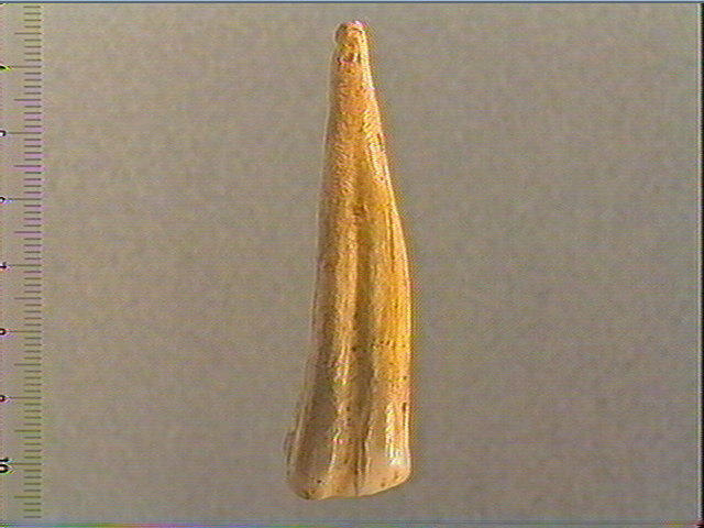 Dent_2