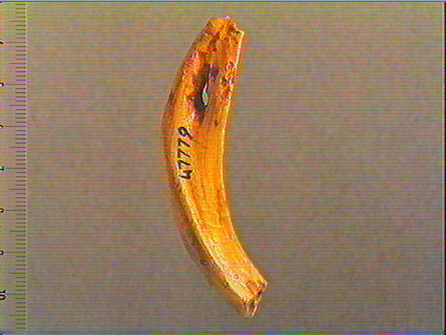 Dent_3