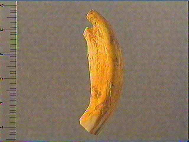 Dent_0