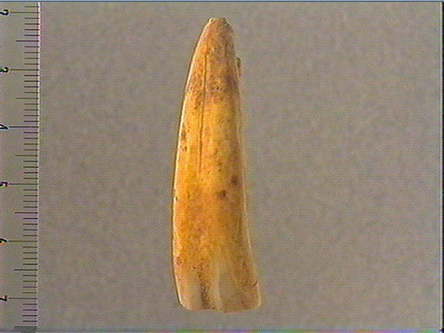 Dent_1