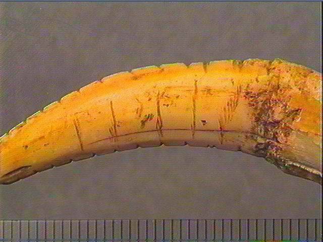 Dent_5