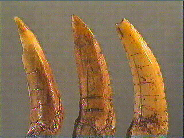 Dent_3