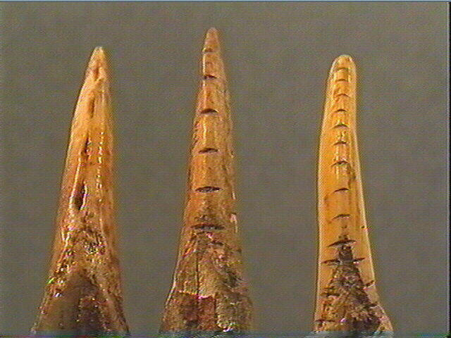 Dent_4