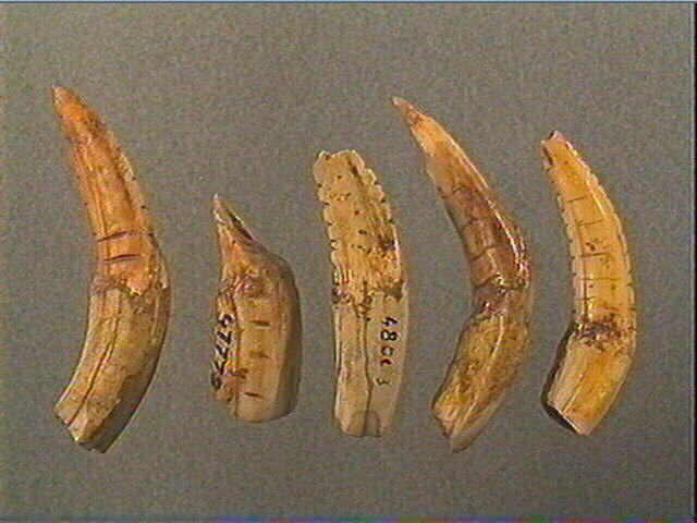 Dent_1