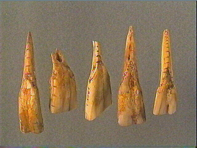 Dent_2
