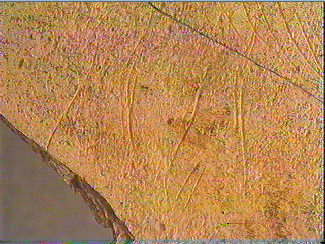 Scapula_4