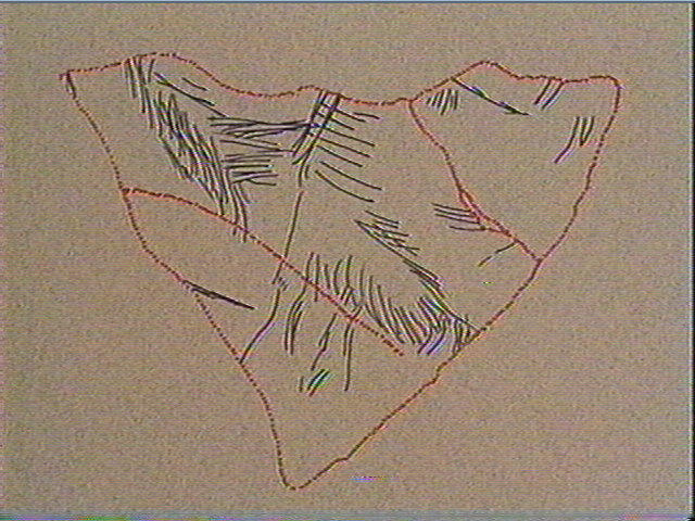Scapula_5