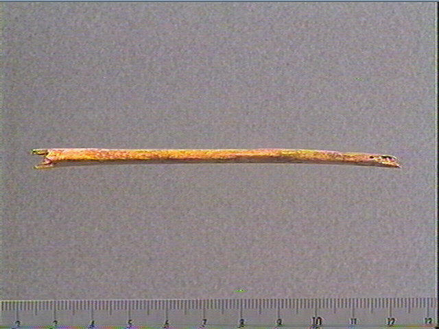 Côte_2