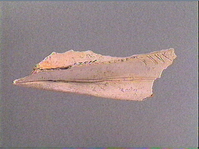 Scapula_1
