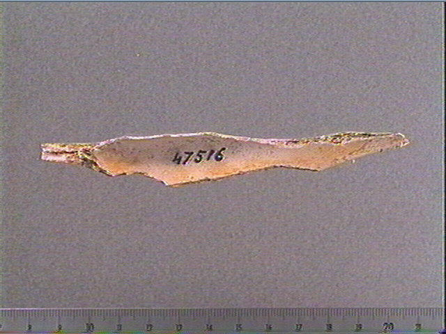 Scapula_2