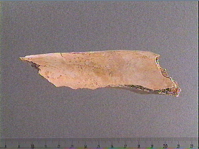 Scapula_3