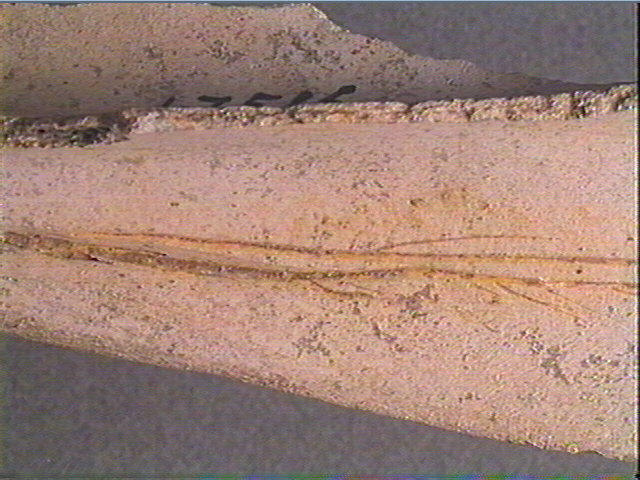Scapula_5