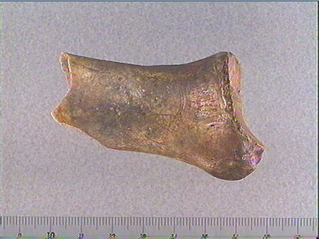 Scapula_0