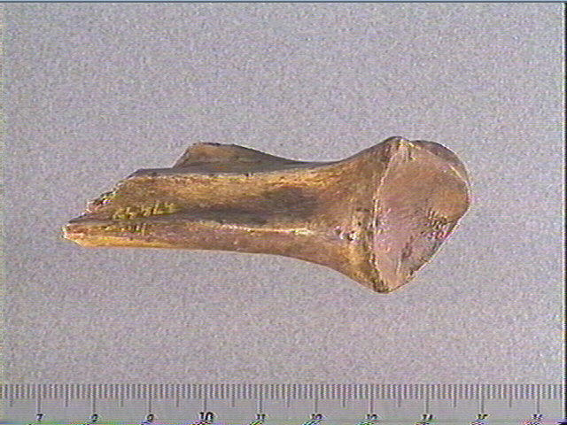 Scapula_1