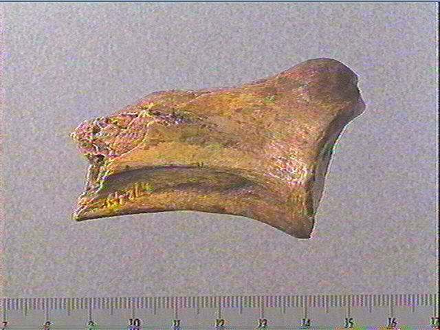 Scapula_2
