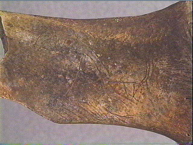 Scapula_3