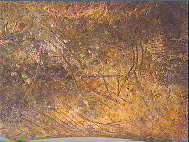 Scapula_4