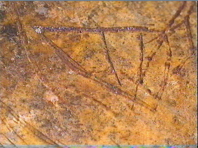 Scapula_5