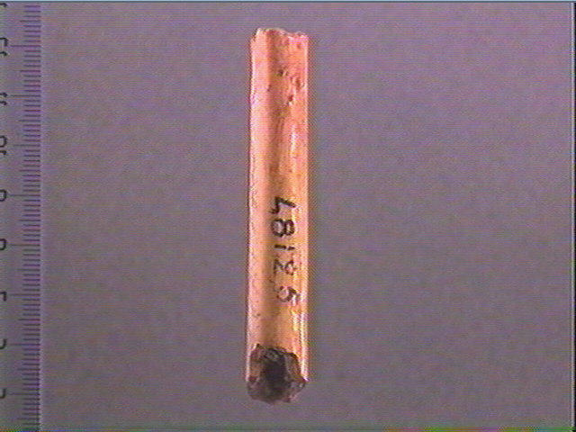 Os indéterminé_1
