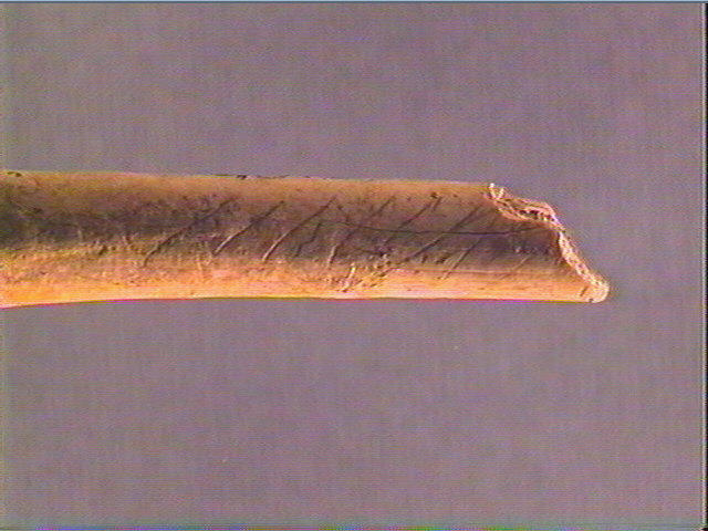 Os indéterminé_4