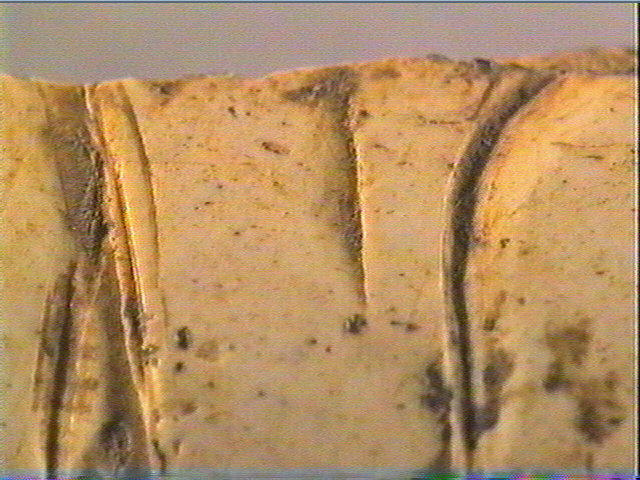 Os indéterminé (2)_2