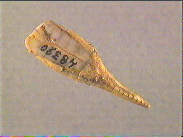Dent_1