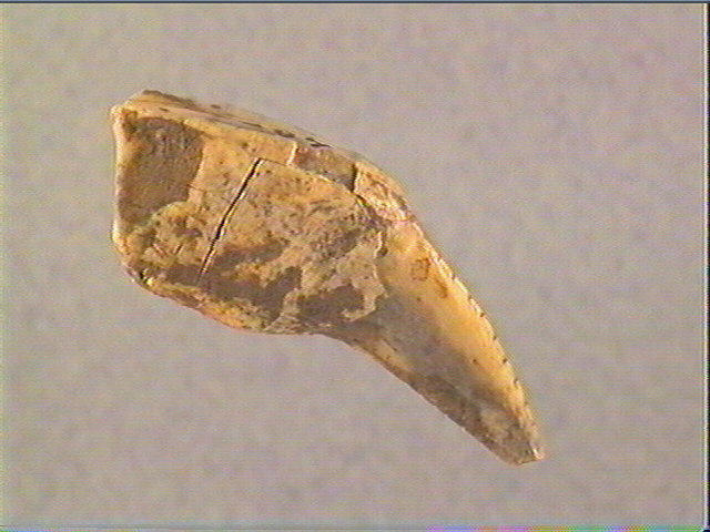 Dent_2