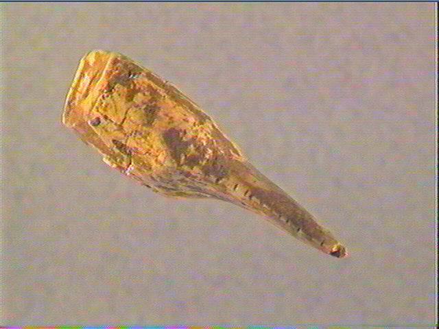 Dent_3
