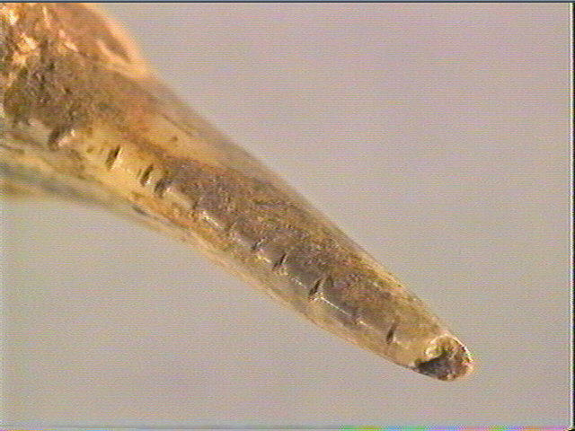 Dent_4