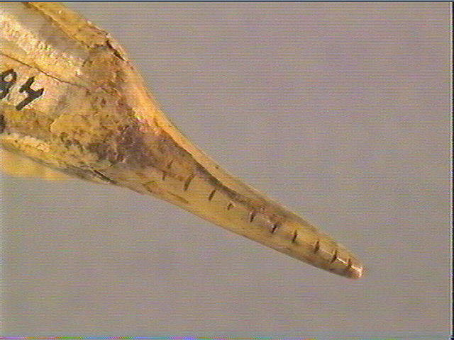 Dent_5