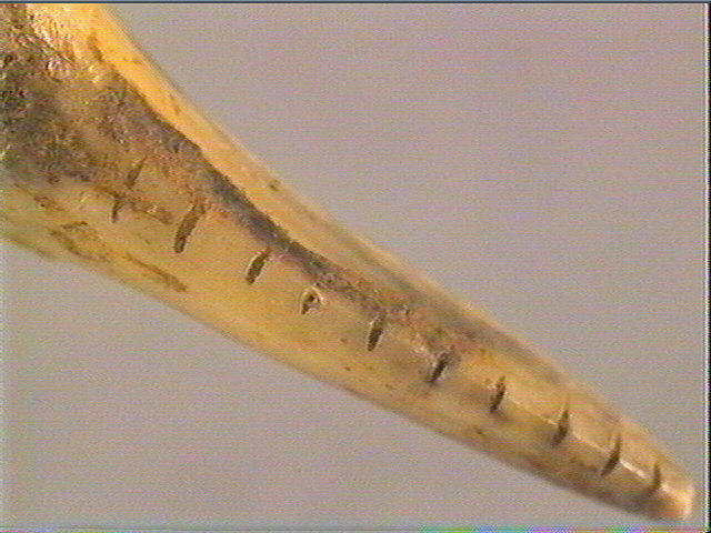 Dent_6