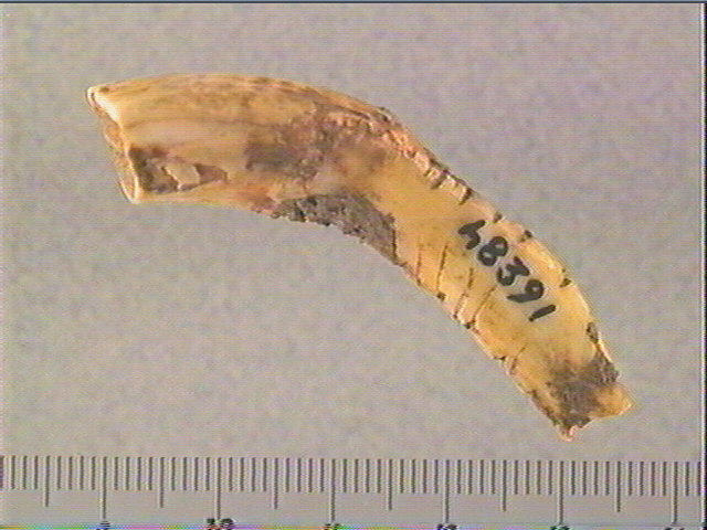 Dent_0