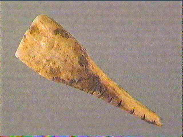 Dent_1