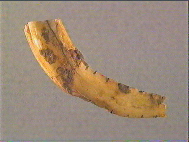 Dent_2