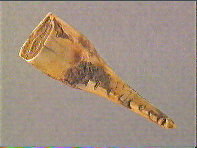 Dent_3