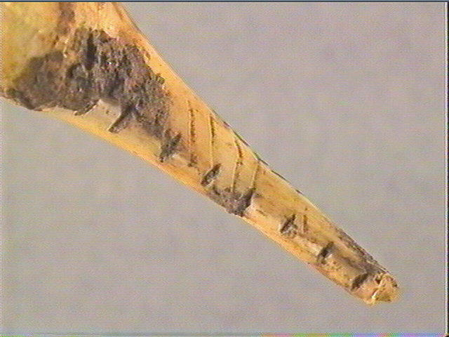 Dent_4