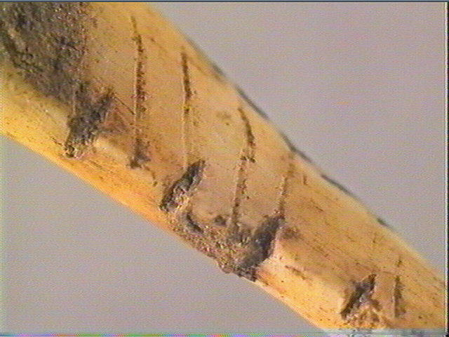 Dent_5