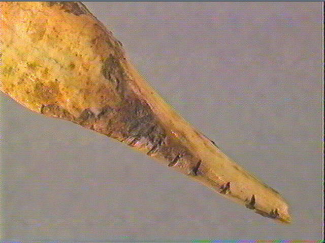 Dent_6