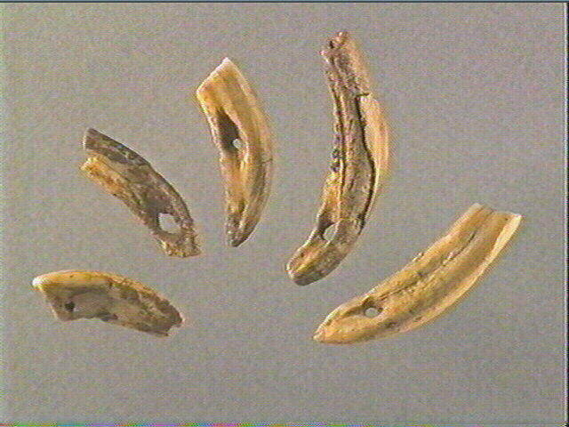 Dent_1