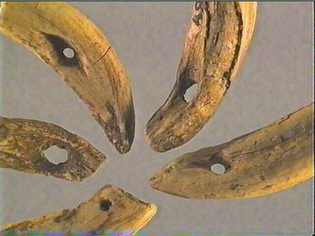 Dent_3