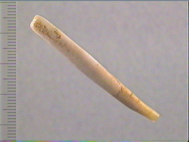 Dent_0