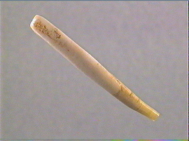 Dent_1