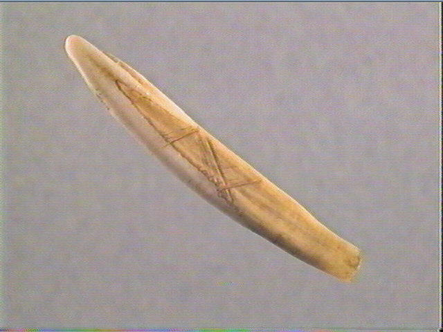 Dent_2