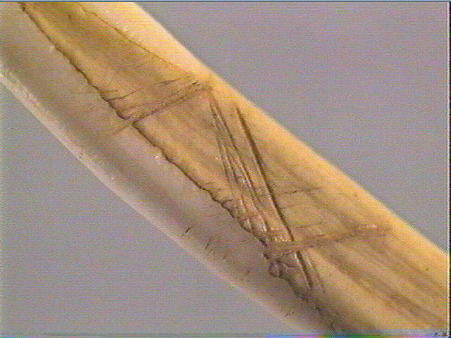 Dent_3
